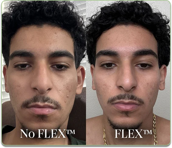 Before and after comparison