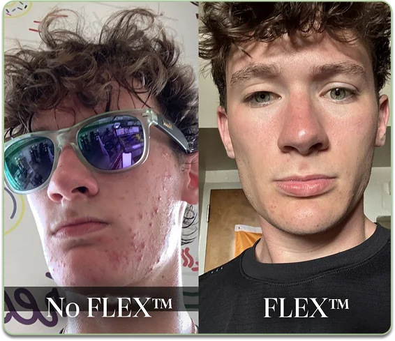 Before and after comparison
