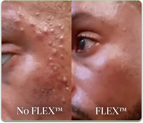 Before and after comparison