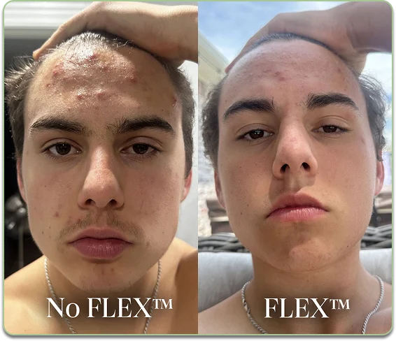Before and after comparison