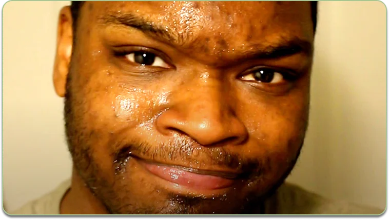 Before and after comparison