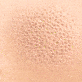 Man using FLEX device