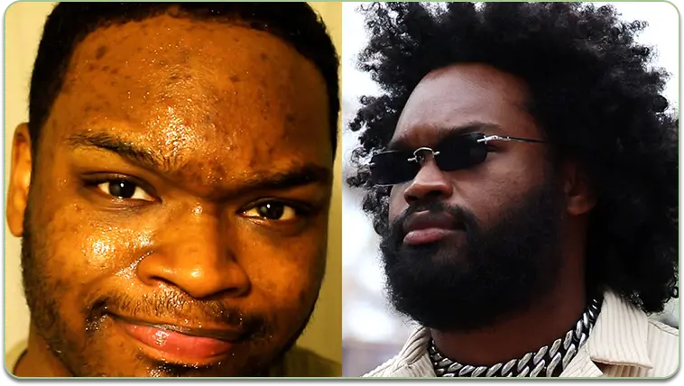 Before and after comparison