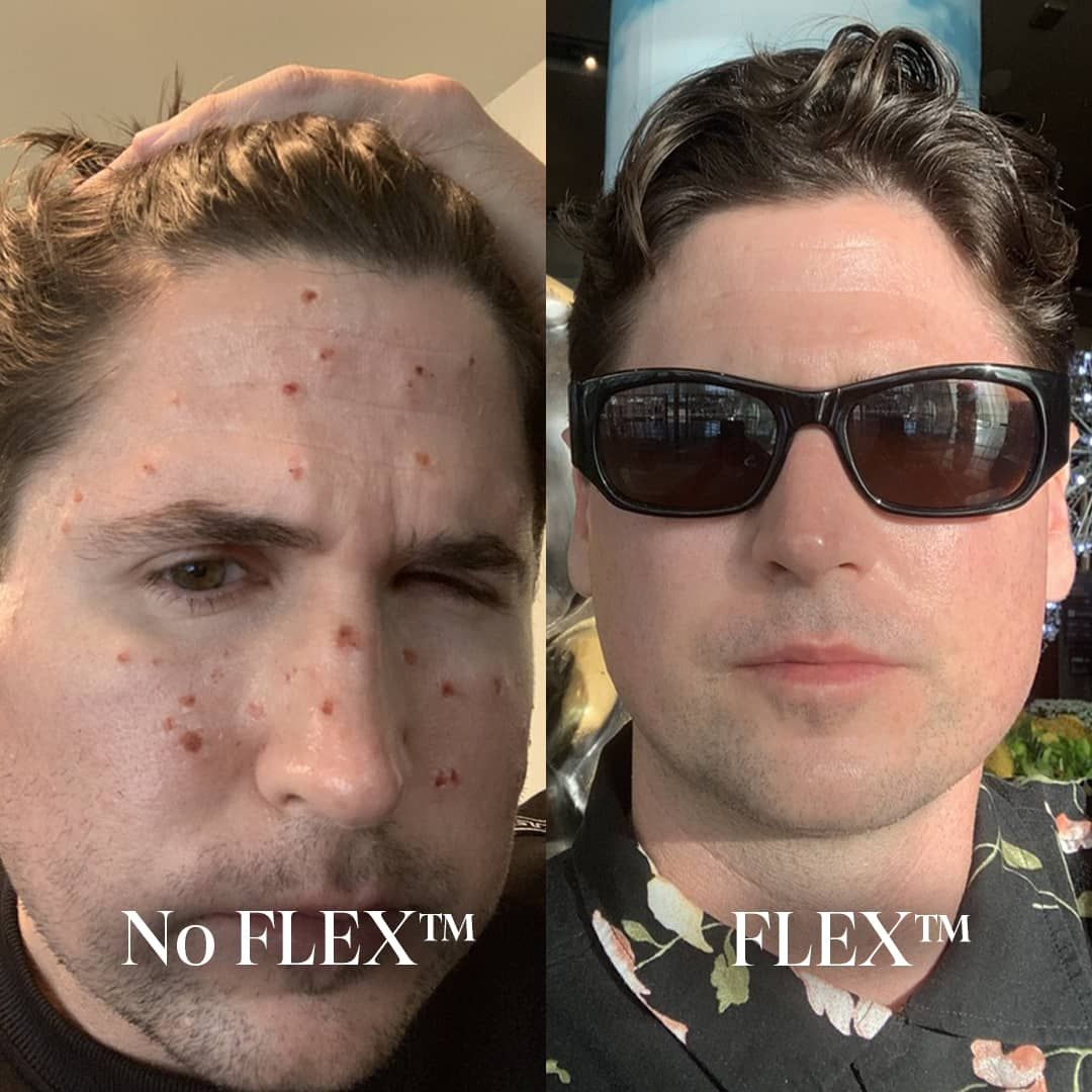 Before and After Result 1
