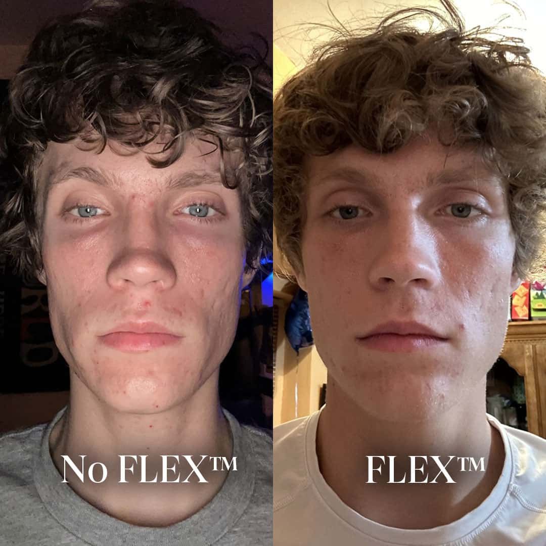Before and After Result 3