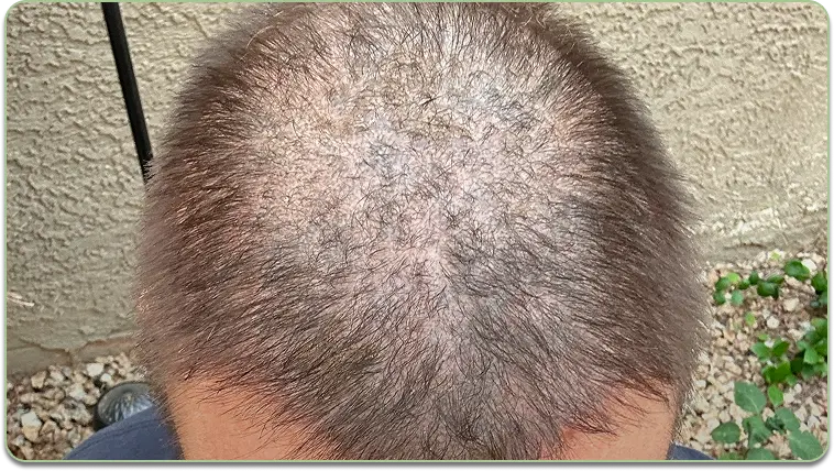 Before and after comparison