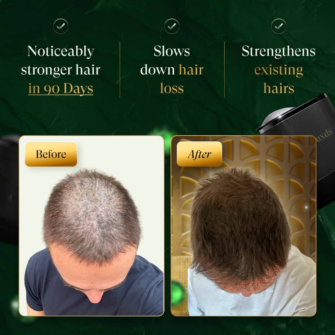 RIZE Before After Results