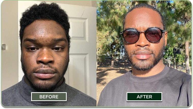 Before and after results