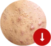 Breakouts visual